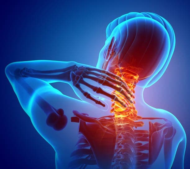 Physiotherapy for Cervicals / Neck Pain